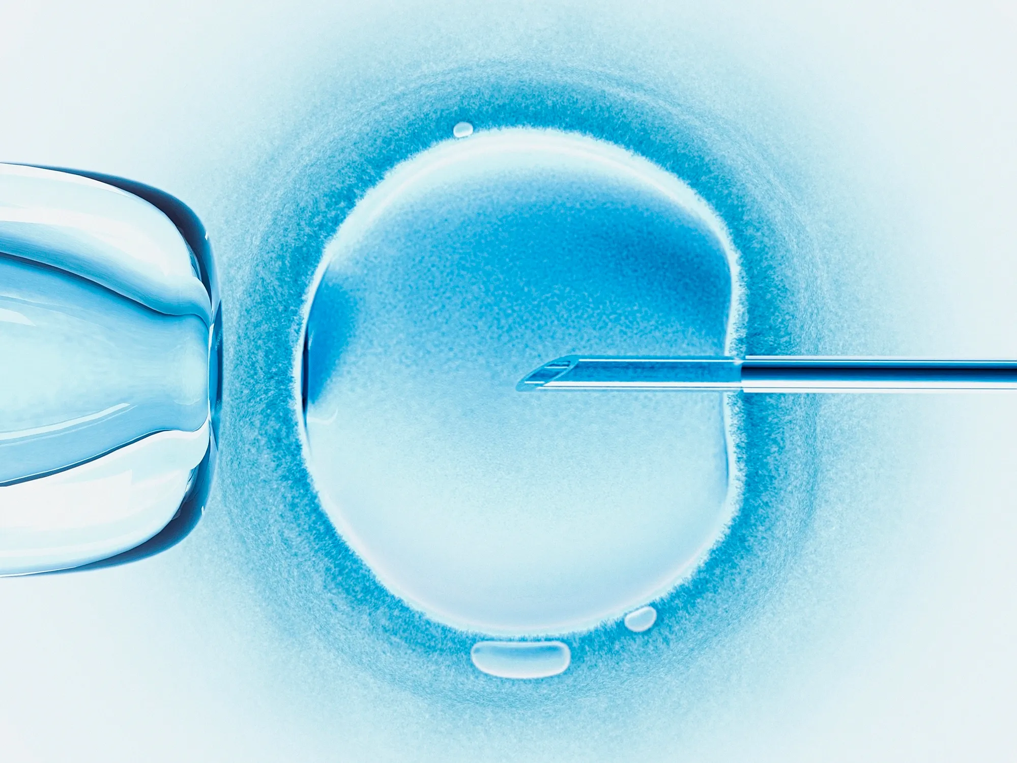 IVF concept art